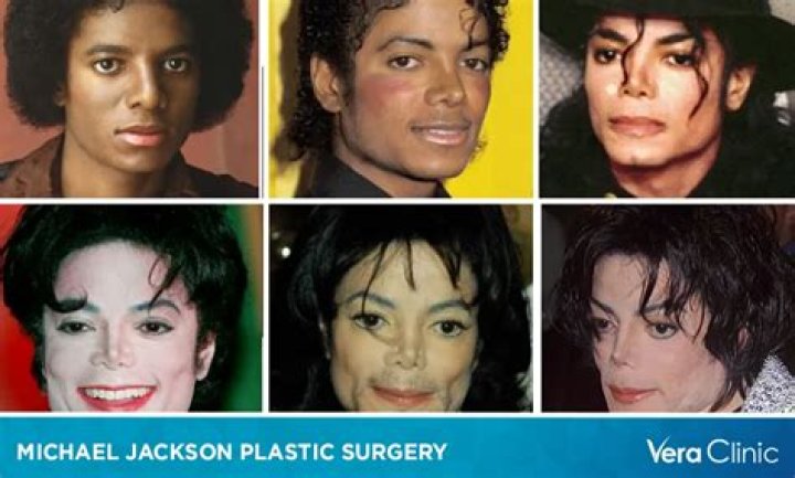Chris Rock's Nose Job Journey For HorizonHerald23